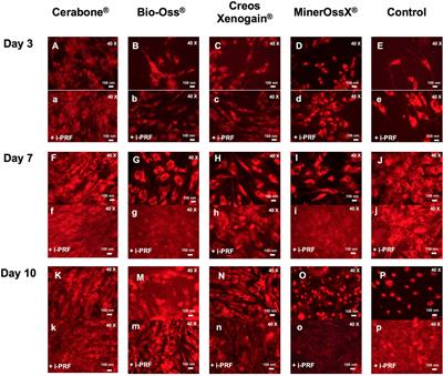 Activation of Human Osteoblasts via Different Bovine Bone Substitute Materials With and Without Injectable Platelet Rich Fibrin in vitro